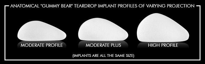 img-5-gummy bear-teardrp-implant-different-profiles-CPG-implant-profiles_edit_H